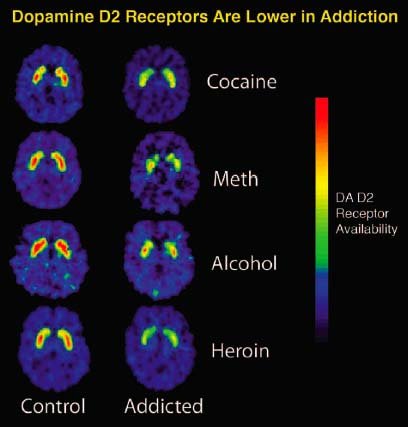 Dopamine in orgasm